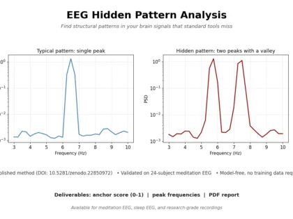 Mən sizin EEG məlumatlarınızda gizli teta-zolaqlı struktur n&uuml;munələrini peer-reviewed metoddan istifadə edərək aşkar edəcəyəm